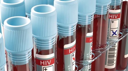 HIV effort let down by test shortages, says WHO