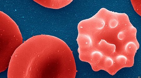 Malaria stopped with single dose of new compound