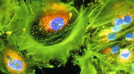 Immunotherapy cancer drug hailed as 'game changer'