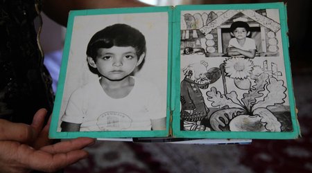 Onun da yaşamaq haqqı var idi - FOTOLAR