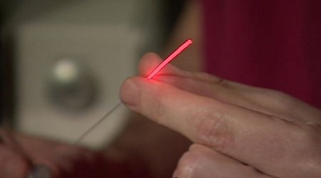 Prostate cancer laser treatment 'truly transformative'