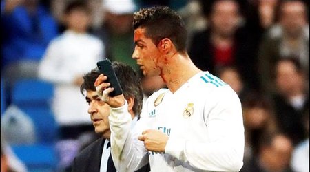 Ronaldo tanınmaz hala düşüb