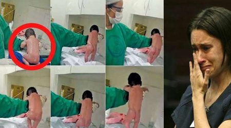 ​Yeni doğulan körpə həkimləri şoka saldı - VİDEO