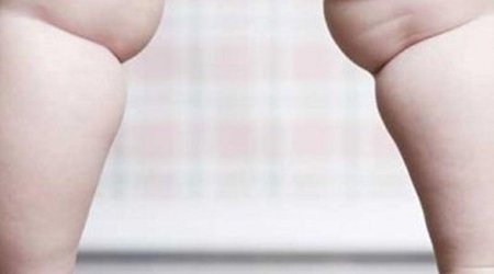 30 yaşına kimi qız kimi böyüdüldü, sonra kişi çıxdı – Azərbaycanda
