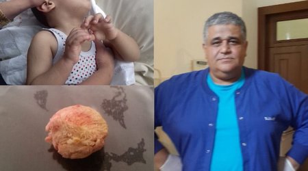 BAKIDA CƏRRAH UŞAĞIN BOĞAZINDA GÖRÜN NƏ QOYDU - FOTO