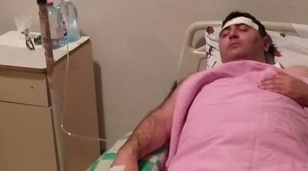 Отец избитого директора: У моего сына сильные боли