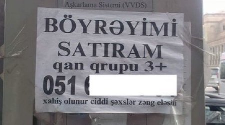Bakıda vətəndaş orqanlarını satışa çıxardı - VİDEO