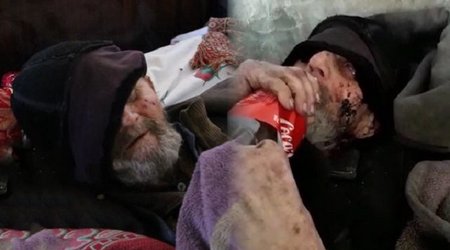 Bakıda gözləri görməyən kimsəsiz qocanın üzünü siçovullar yedi - VİDEO
