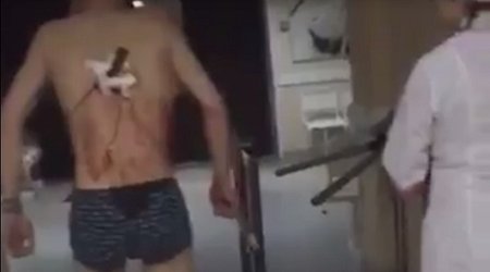Həkimlər belindəki bıçağı çıxarmamış, qalxıb qan Içində siqaret çəkməyə getdi – VİDEO 18+