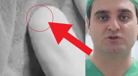 Azərbaycanda ŞOK! Həkim ikinci dəfə sünnətə gələn uşağı qıza çevirdi - VİDEO