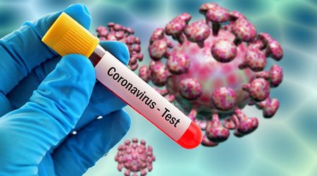 Türkiyədə böyük bir şəhərdə xeyli virus daşıyıcısı olduğu bildirildi - VİDEO