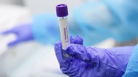 Azərbaycanda son sutkada koronavirusa yoluxanların sayı AÇIQLANDI