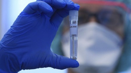 Russia registers 18,985 COVID-19 cases in past 24 hours