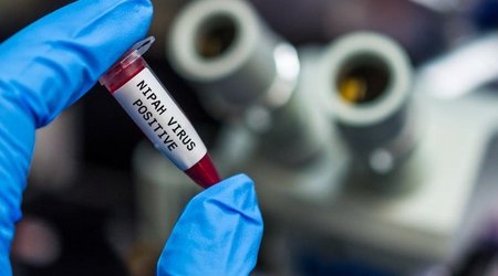 Outbreak of deadly Nipah virus recorded in India