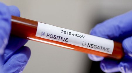Armenia's coronavirus death toll reaches 4,924