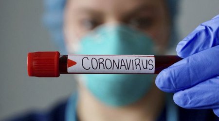 Russia records 790 coronavirus related deaths over past day
