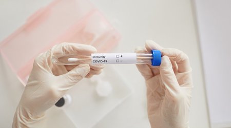 Armenia sees over 60 COVID-related deaths per day
