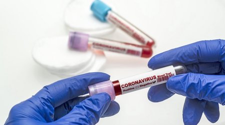 Russia reports 1,181 more coronavirus deaths