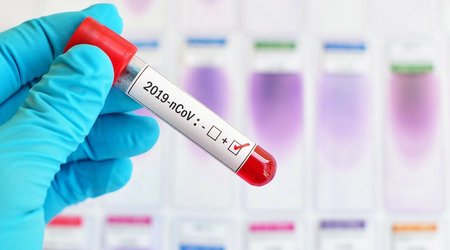 Georgia stops publishing daily coronavirus statistics