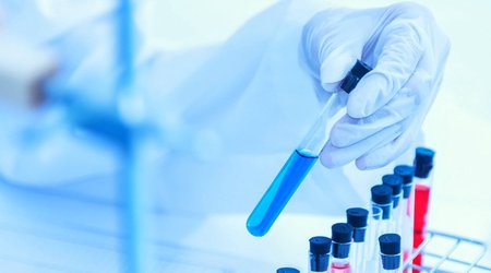 ICRC takes biological samples from families of 316 people missing in 1st Karabakh War