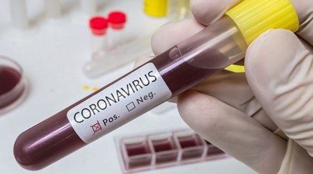 В Азербайджане за последние сутки не выявлено случаев заражения коронавирусом