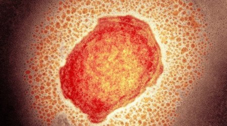 UK confirms 71 more monkeypox infection cases
