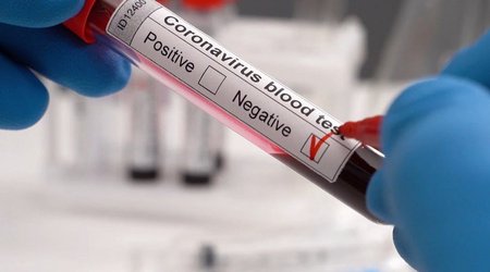 US cancels pre-boarding COVID testing requirement