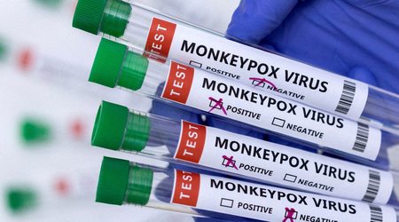TABIB announces methods of protection against monkeypox