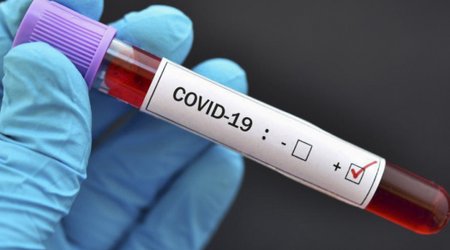 В Азербайджане 36 новых случаев COVID-19
