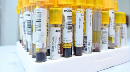 Статистика по COVID в Азербайджане