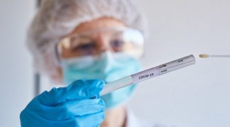 В Азербайджане за последние сутки коронавирусом заразились 105 человек