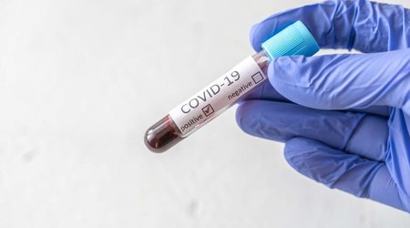 New strain of coronavirus found in Russia