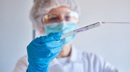 Заболеваемость коронавирусом в Азербайджане растет