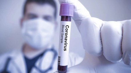 В Азербайджане зарегистрировано 46 новых случаев заражения коронавирусом