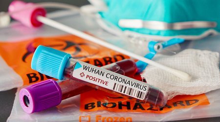 В Азербайджане выявлено 24 новых случая заражения коронавирусом