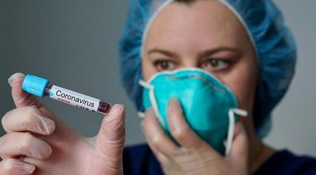 В Азербайджане за последние сутки коронавирусом заразился 71 человек