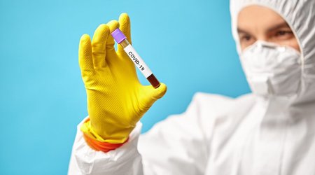 В Азербайджане за сутки 11 человек заразились коронавирусом