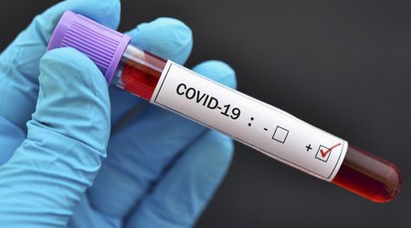 Litvada yeni COVID-19-a gün ərzində 72 nəfər yoluxub
