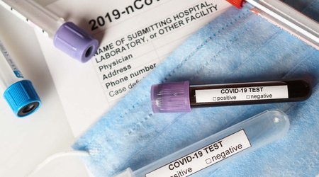 В Грузии растет число случаев заражения COVID-19