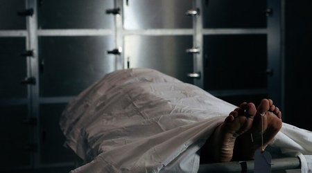 Получивший травму головы мужчина скончался в Хачмазской больнице