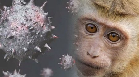 Meymunçiçəyinə yoluxmuş 100-dən çox pasient xəstəxanadan qaçıb - KİV