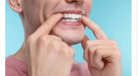 Alimlərin araşdırması deyir ki, implant 40 il insana xidmət edə bilər