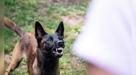 В Сумгайыте шесть человек госпитализированы из-за укуса собаки