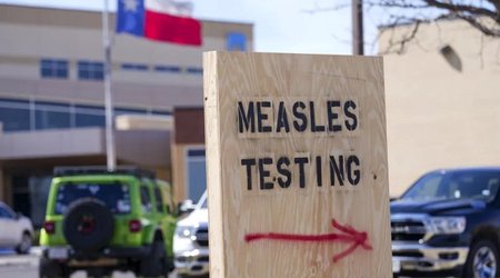 Число заразившихся корью в США превысило 700 человек
