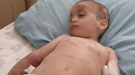 Ağdamda iki yaşlı uşaq döyülüb