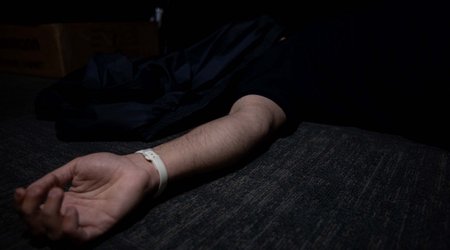 Azerbaijan reports over 50 successful transplants from deceased donors in 2025