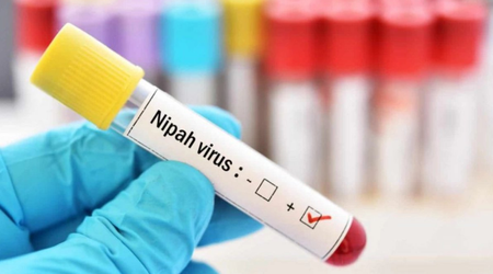 Nipah virus and global exposure: is Azerbaijan immune to the risk?