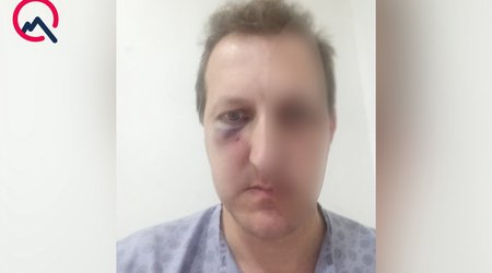 Bakıda Xalq artistinin oğlu döyülüb, bir nəfər saxlanılıb