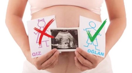 Abortion rate in Azerbaijan surges 3.6-fold over 15 years