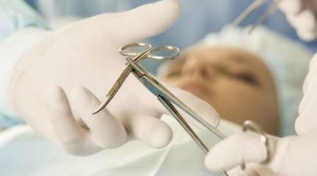 Abortion Rates in Azerbaijan Rise 21.9% in 2025, Statistics Committee Reports